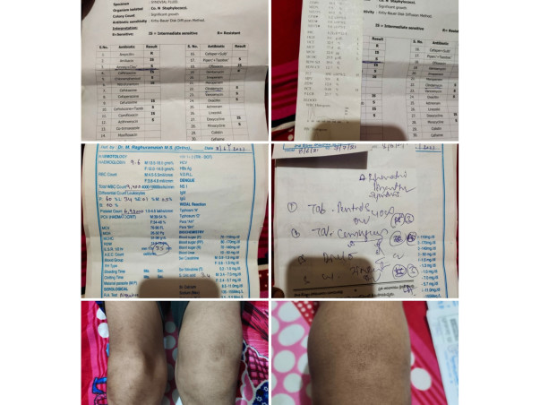 Shaik Suhail Needs Your Urgent Support.