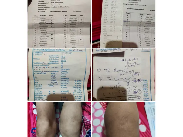 Shaik Suhail Needs Your Urgent Support.