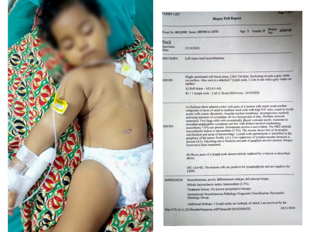 Support Dithya Atti Recover From Neuroblastoma Cancer