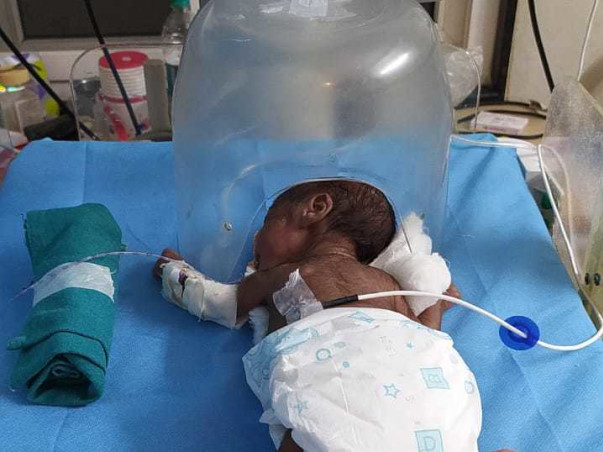 Support Baby Of Anitha Recover From Preterm Birth