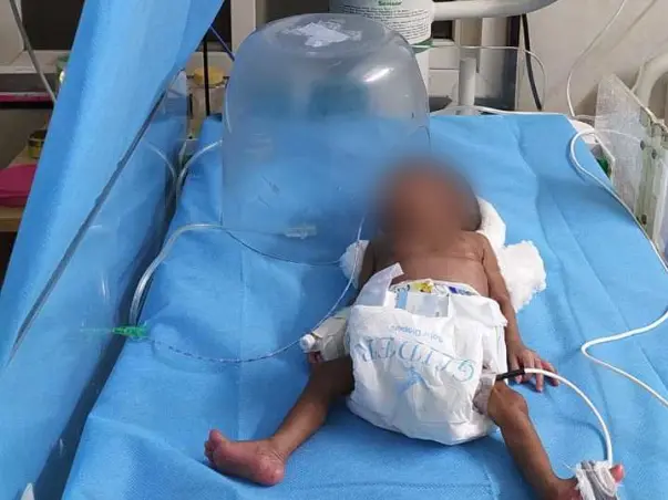 Support Baby Of Anitha Recover From Preterm Birth