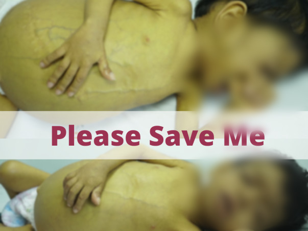 Support Angel Chirag Parmar Recover From Liver Failure