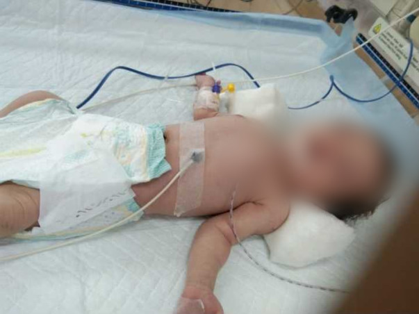 Help Dasyam Sai's Daughter(20 Days Old Baby)