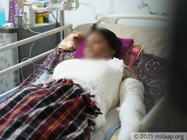 A Live Wire Left This 13-Year-Old With Severe Burns, Help her!