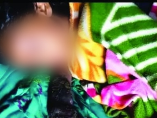 Help Manju Recover From Snake Bite