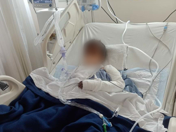 Support 9 Yrs/O Annu Kumari Recover Serious Road Accident Injuries