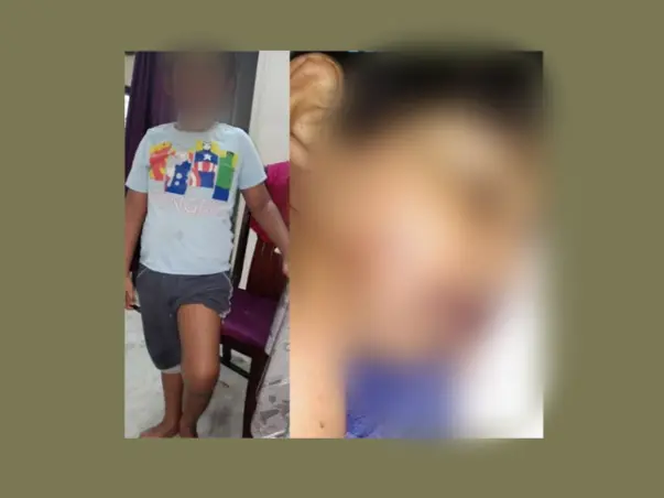 Fundraiser for 10 yr old boy suffering with Hemophilia(blood bleeding)