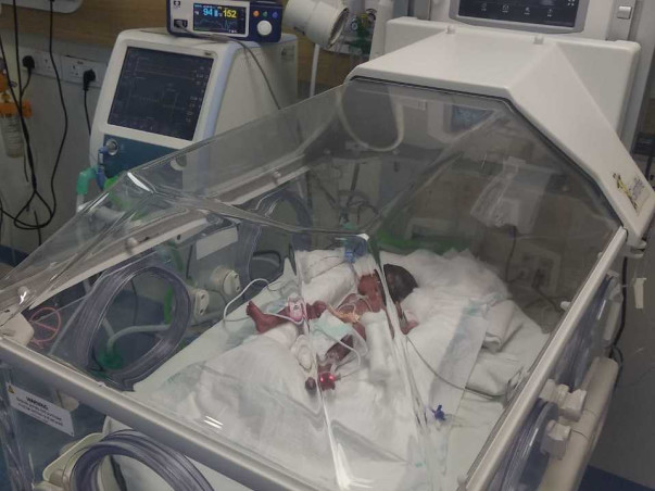 Support Kumar Swami To Save His Premature Baby(Girl)