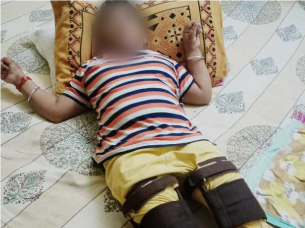 Support My Son Amol Shrivastav To Recover From Cerebral Palsy