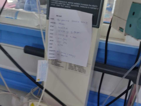 Please Help My Sister's Preterm Birth Twins Girl Babies