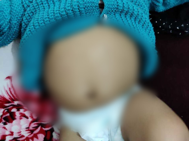 Support Sarvi Recover From Liver Cirrhosis