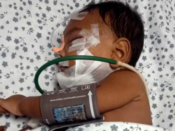 Help Arjun Kumar 8months Old Boy Bitten By Mad Dog