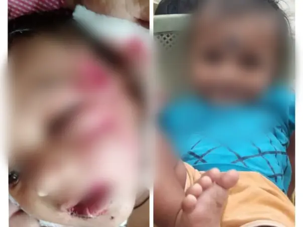 Help Arjun Kumar 8months Old Boy Bitten By Mad Dog
