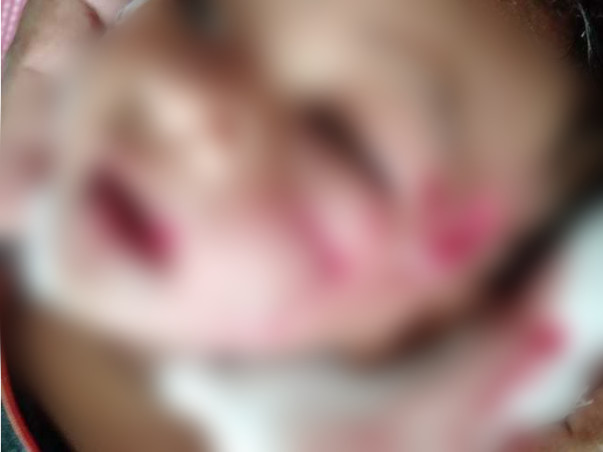 Help Arjun Kumar 8months Old Boy Bitten By Mad Dog