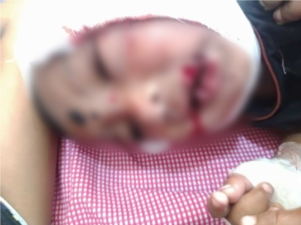 Help Arjun Kumar 8months Old Boy Bitten By Mad Dog