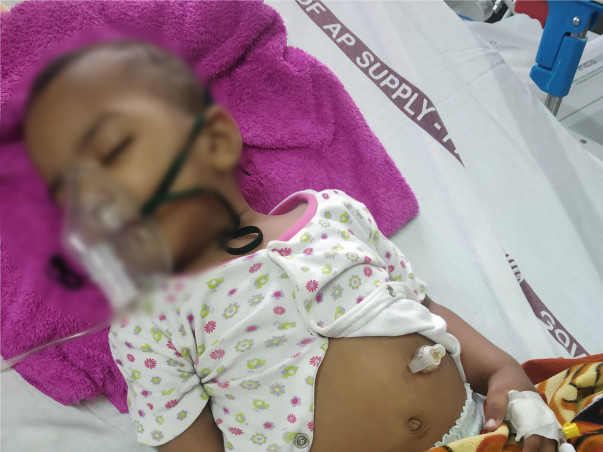 Support My 15 Months Old Child, Recover From Brain Disease.