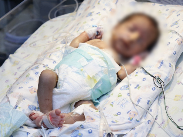 This 2-Month-Old's Intestines Are Dissolving, He Needs Urgent Surgery