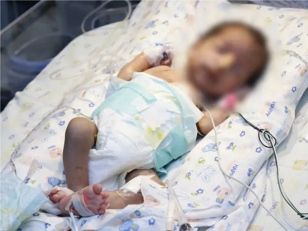 This 2-Month-Old's Intestines Are Dissolving, He Needs Urgent Surgery