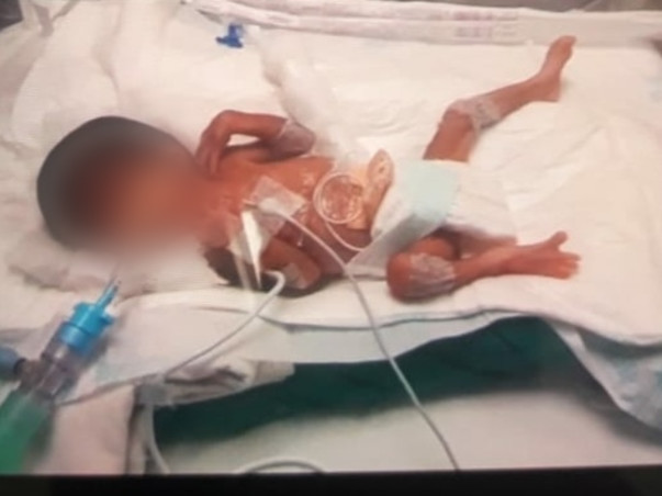 Support Kumar Swami To Save His Premature Baby(Girl)