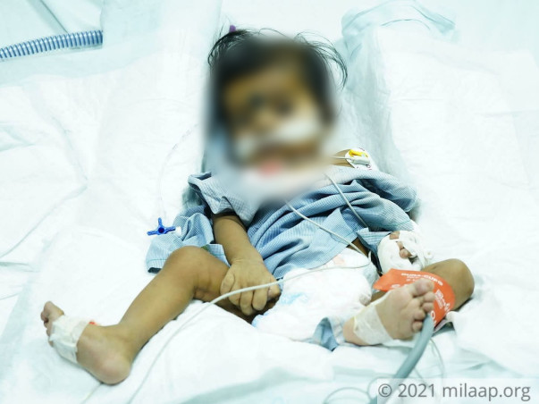 7-Month-Old Struggles To Breathe Because of Rare Congenital Condition