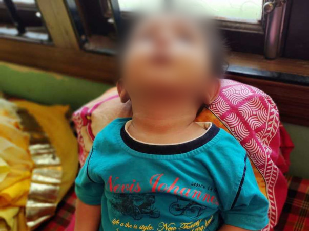 Save Aayansh Life From SMA Type-1 Disease - 16 Cr For The Drug