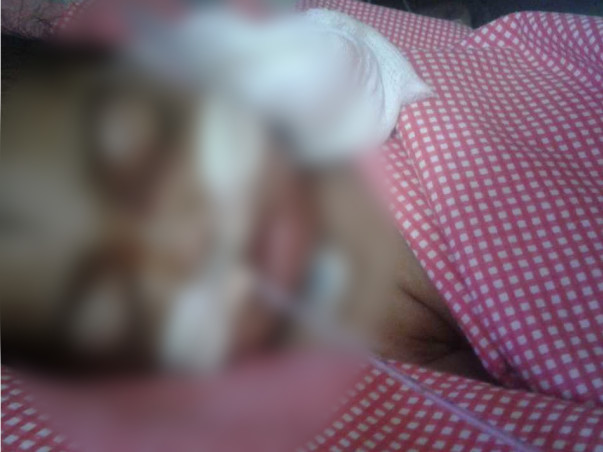 Help 6 Month old baby Recover From Dengue