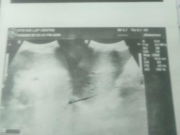 Support Shaik Daniyal Hussain To Recover From Kidney Failure