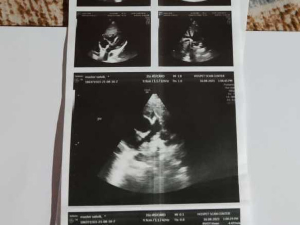 Help Baby Sathwik Raise Funds For His Heart Surgery