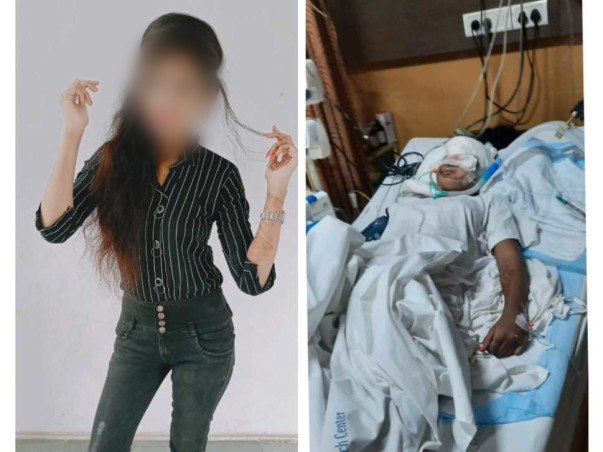 Help My Sister Recover From Brain and Face Injury Due To Accident