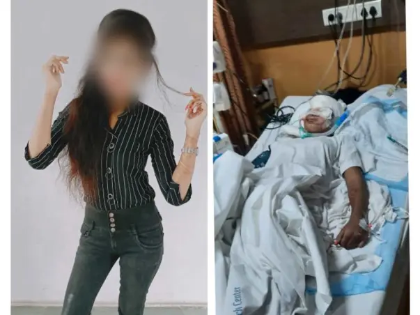 Help My Sister Recover From Brain and Face Injury Due To Accident