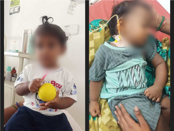 1-Year-Old Iniyan.S Needs Your Help Fight Severe Aplastic Anemia