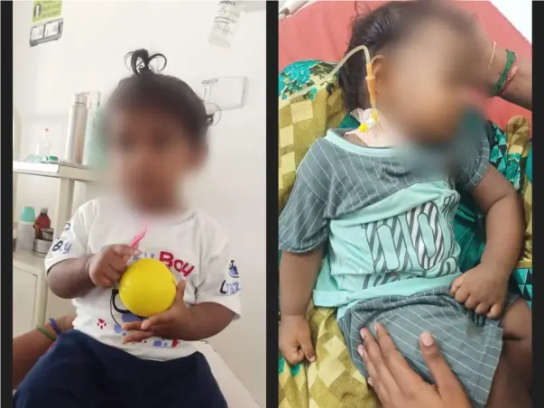 1-Year-Old Iniyan.S Needs Your Help Fight Severe Aplastic Anemia