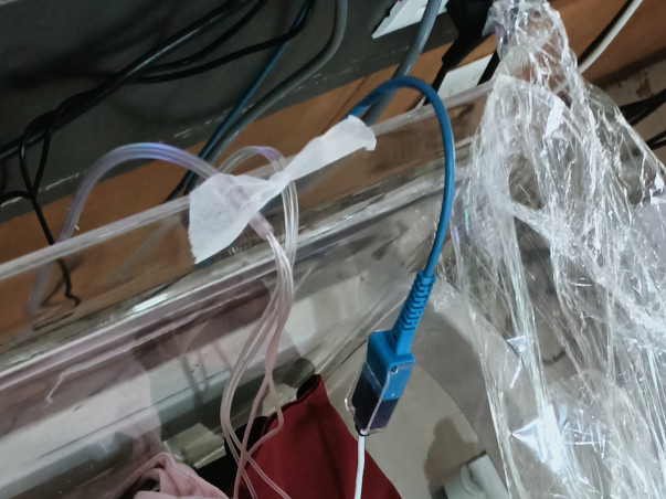 Support Baby Of Dhara To Recover From Heart Disease