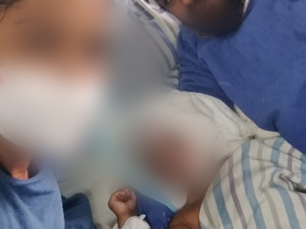 Support Dhanika Recover From Accidental Fire Burn