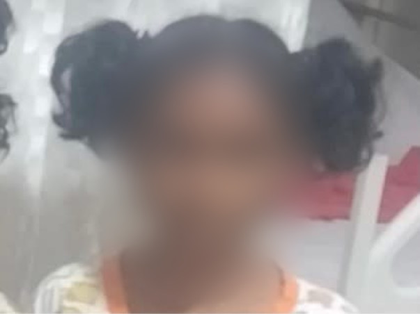 Help Harchatha K To Undergo Double Switch Open Heart Surgery