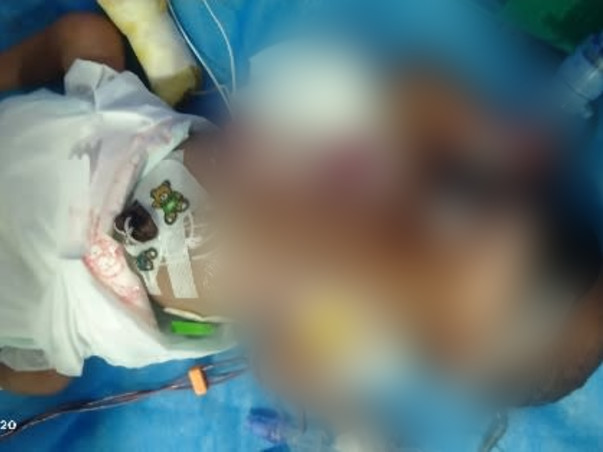 Support My Baby To Recover From Premature Birth