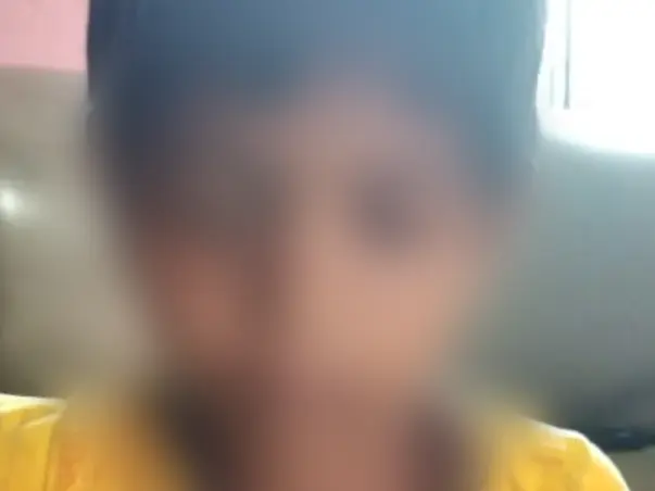 Support Suman Sk Recover From Chicken Pox And Limbal Stem Cell