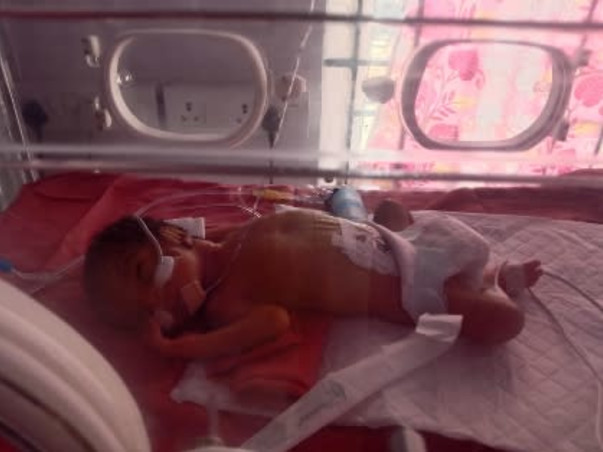 Help Triplet Babies Fight Pre Mature birth