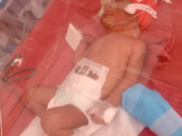 Help Triplet Babies Fight Pre Mature birth