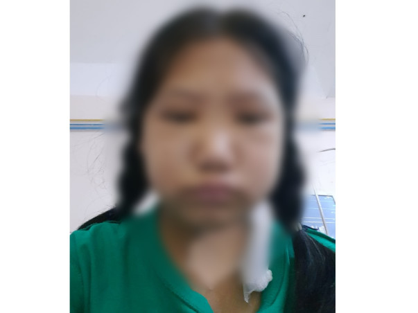 Help My Daughter, Yamra Yanu Recover From Both Kidney Failure