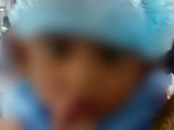 Support Baby Nihaan Sai For Liver Transplantation Suffering with EHBA