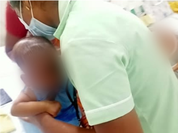 Support Baby Nihaan Sai For Liver Transplantation Suffering with EHBA