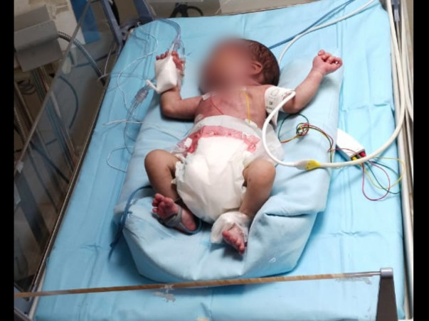 Raise Fund & Save Baby