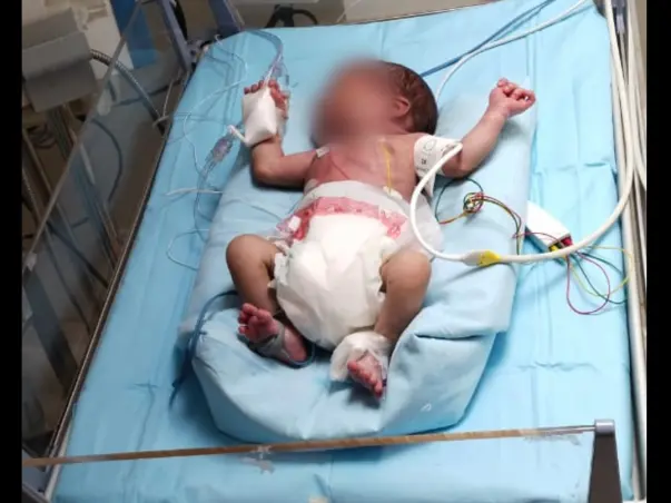 Raise Fund & Save Baby
