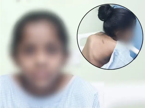 Help my daughter fight Hello traction And scoliosis correction