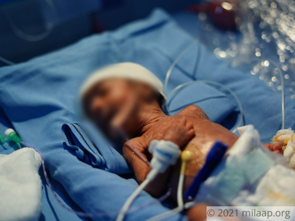 help-baby-of-lakshmi-p