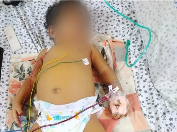 Support Aayat Unissa To Recover From Liver Damage