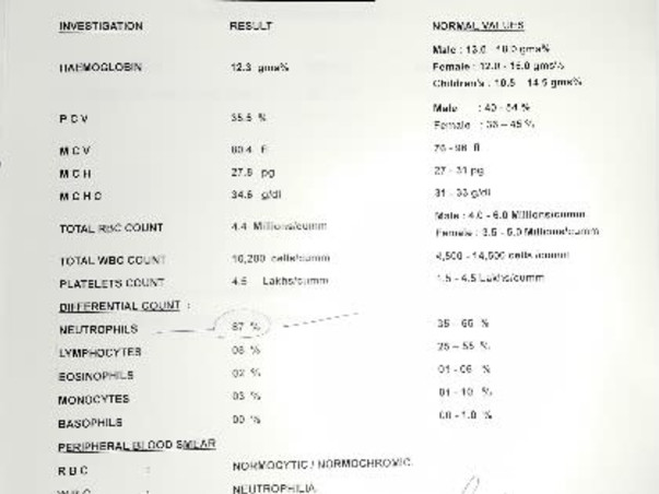 6 Years Old Anas Nawaz Needs Your Help Fight Dengue Fever & Blood Infection