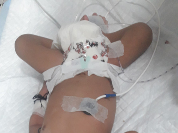 Help 1-month-old Master Abuzar Recover From Pyloric Stenosis