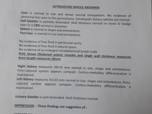 Help 1-month-old Master Abuzar Recover From Pyloric Stenosis
